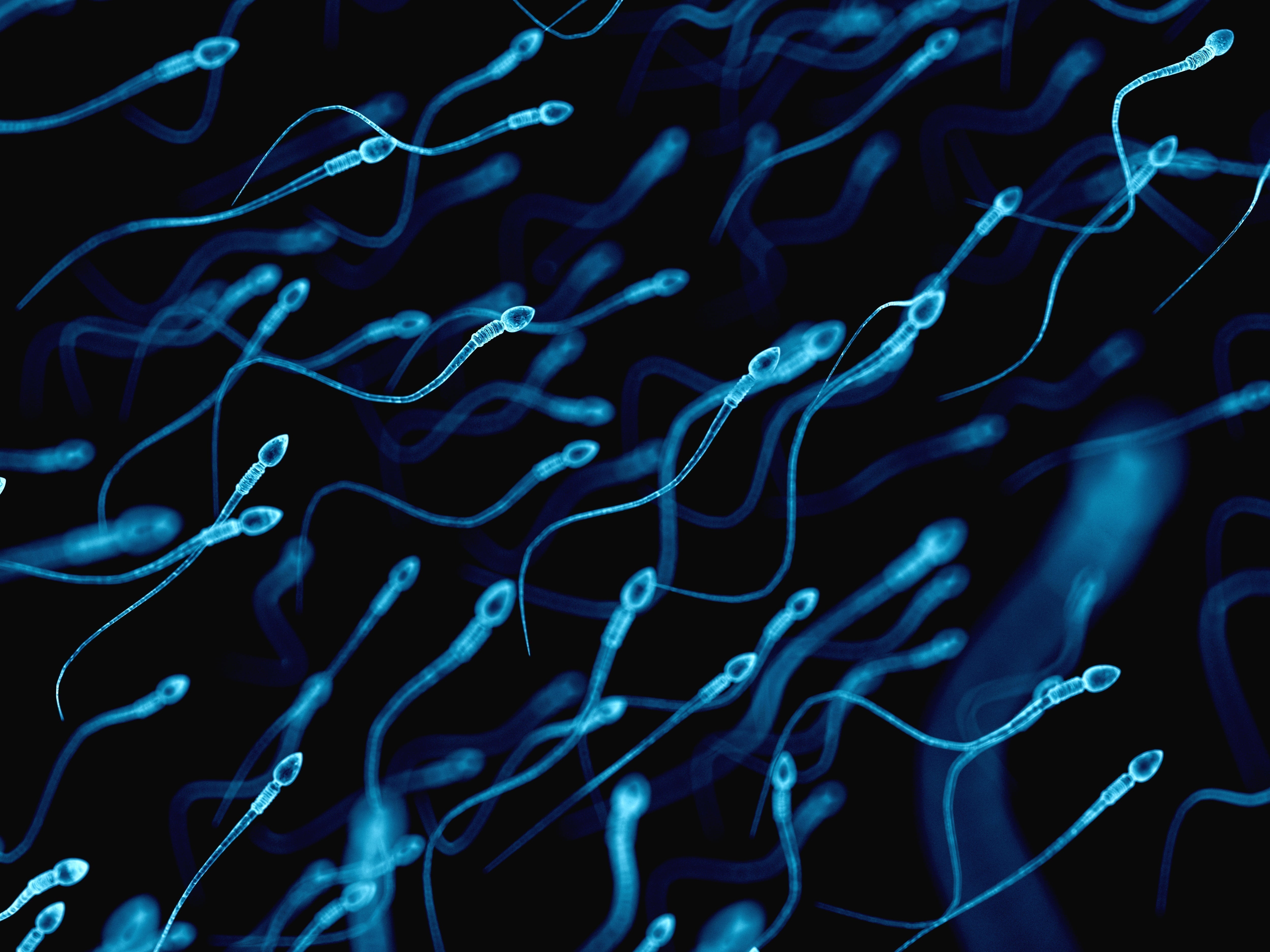 Millionaires Are Racing Their Sperm? But Is Speed Really That Important? Millionaires Are Racing Their Sperm? But Is Speed Really That Important?